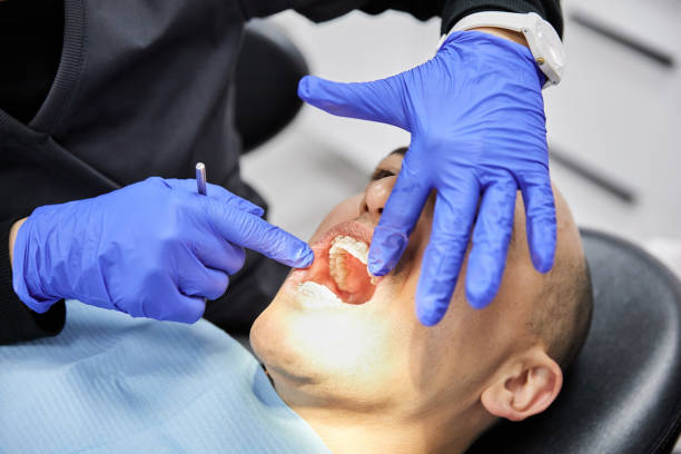 Best Emergency Dentist for Lost Fillings or Crowns in Southmont, PA